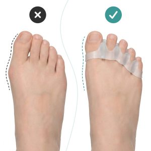 Alternative view of OrthoRelax® – Separator do Palców w Żelu (2 separatory)