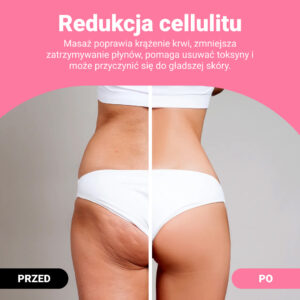 Alternative view of GUASHA – wałek do modelowania ciała dla widocznej redukcji cellulitu i tkanki tłuszczowej