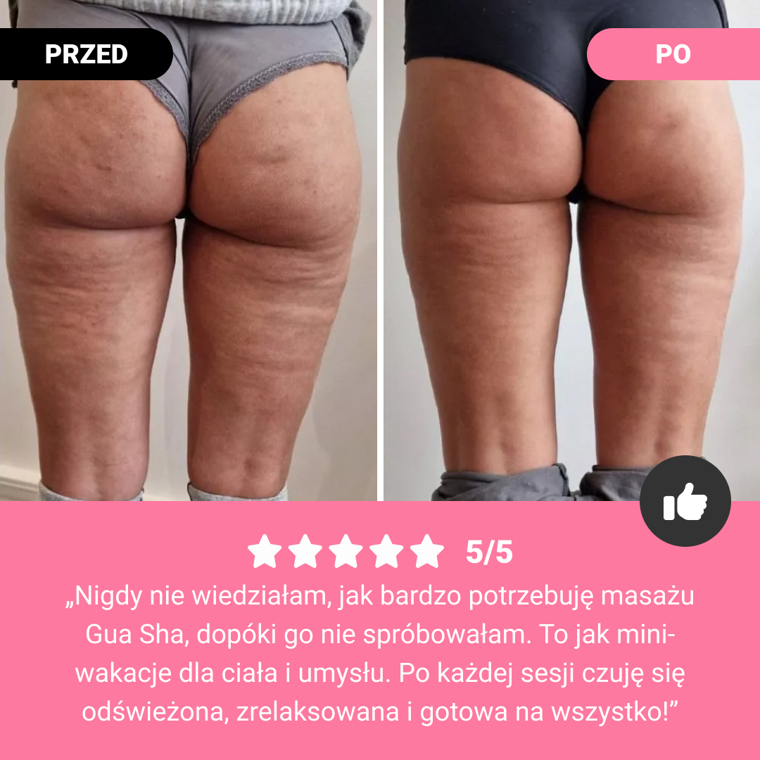 GUASHA – wałek do modelowania ciała dla widocznej redukcji cellulitu i tkanki tłuszczowej - obrazek 7